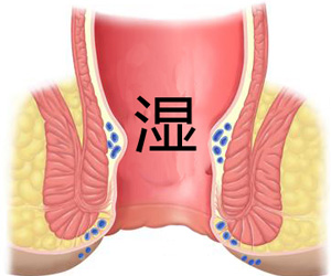 肛门潮湿有哪些症状